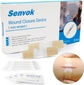 Kit - 2 Senvok Wound Closures Devices, Gauze, Antiseptic Wipe